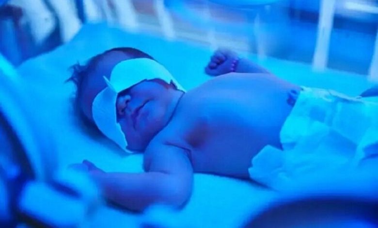ناسازگاری خونی؛ مهم‌ترین علت زردی شدید نوزادان