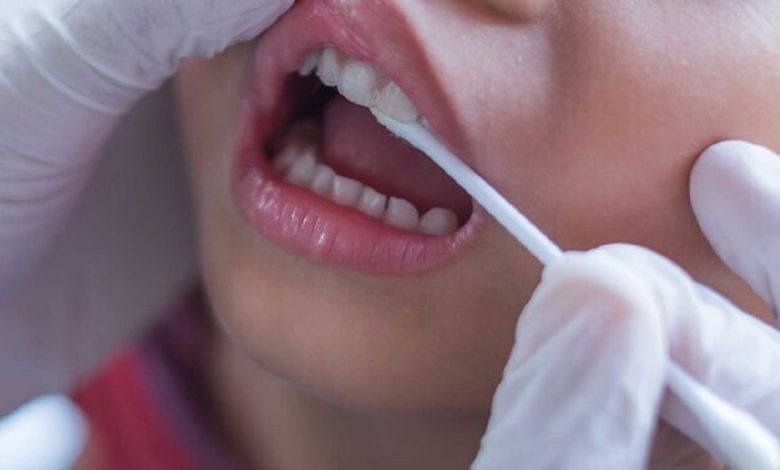 شیوع بالای انگل‌های دهانی در بیماران دیابتی